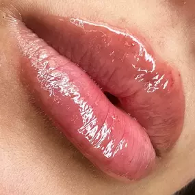 LR LIP FILLERS