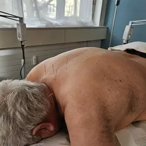 Bild von Oase TCM - Akupunktur