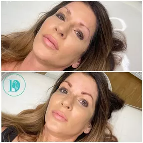 Bild von DModern Beauty Microblading, Lash, Skin Studio Laguna Niguel