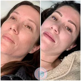 Bild von DModern Beauty Microblading, Lash, Skin Studio Laguna Niguel