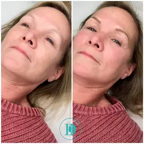 Bild von D’Modern Beauty Microblading, Lash, Skin Studio Laguna Niguel