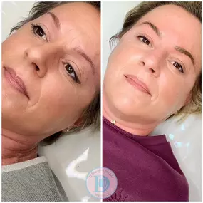 Bild von D’Modern Beauty Microblading, Lash, Skin Studio Laguna Niguel
