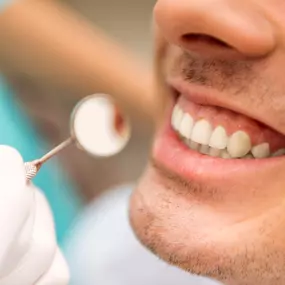 Regular dental cleanings are essential to maintaining a healthy smile. Our expert hygienists will remove plaque and tartar build-up, to help prevent cavities and gum disease. Plus, a fresh cleaning leaves your teeth feeling polished and looking their best! Give a call today to schedule your cleaning appointment!