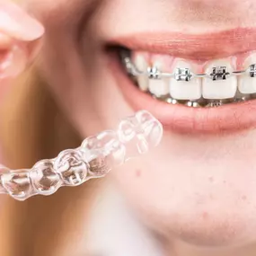 If you think you have not to bright of a smile it might be because of your teeth that are possibly crooked or uneven. Give us a call to make an appointment so you can transform your smile with braces! Whether your an adult, teen or kid everyone should have a beautiful confident smile.