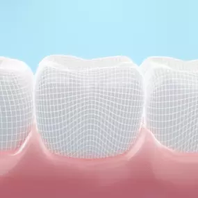 Dental implants are the most effective, long-lasting solution for replacing missing teeth. Unlike dentures, implants are anchored securely into the jawbone, providing a stable and natural-looking result. Schedule a consultation with us today to see if dental implants are right for you!