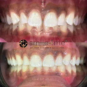 Bild von smile4me Dental Care - Astoria, Queens