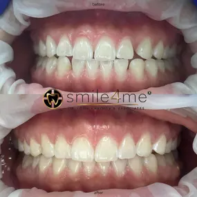 Bild von smile4me Dental Care - Astoria, Queens