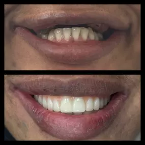 Bild von smile4me Dental Care - Astoria, Queens