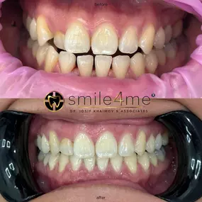 Bild von smile4me Dental Care - Astoria, Queens