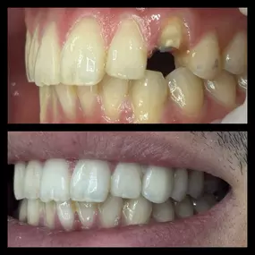 Bild von smile4me Dental Care - Astoria, Queens