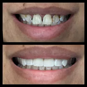 Bild von smile4me Dental Care - Astoria, Queens