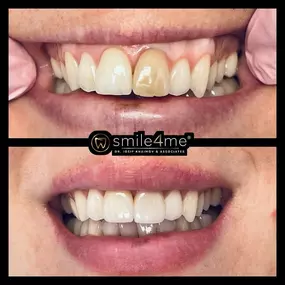 Bild von smile4me Dental Care - Astoria, Queens