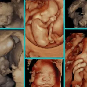 Bild von 3d 4d Baby Ultrasound Boutique