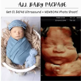 Bild von 4 Baby Newborn Photography & 3d 4d Ultrasounds