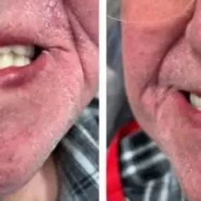 Agape Dental | Dental Implants in Rocklin, CA | Dr. Mignon Mapanao