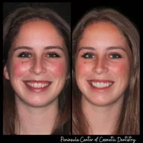 Dentist in Mountain View
PENINSULA CENTER FOR COSMETIC DENTISTRY - MOUNTAIN VIEW
105 SOUTH DR #200
MOUNTAIN VIEW CA 94040
http://pccdsmiles.com/