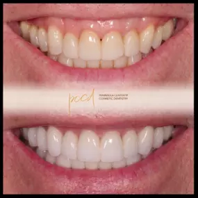 Dentist in Cupertino
PENINSULA CENTER FOR COSMETIC DENTISTRY - CUPERTINO
10055 N PORTAL AVE STE 100
CUPERTINO CA 95014
http://www.pccdsmiles.com/