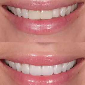 Dentist in Cupertino
PENINSULA CENTER FOR COSMETIC DENTISTRY - CUPERTINO
10055 N PORTAL AVE STE 100
CUPERTINO CA 95014
http://www.pccdsmiles.com/