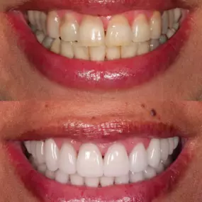 Dentist in Los Altos
PENINSULA CENTER FOR COSMETIC DENTISTRY - LOS ALTOS
99 3RD ST
LOS ALTOS CA 94022
http://www.pccdsmiles.com/