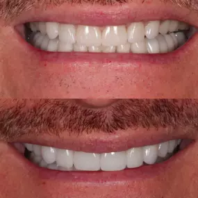Dentist in Los Altos
PENINSULA CENTER FOR COSMETIC DENTISTRY - LOS ALTOS
99 3RD ST
LOS ALTOS CA 94022
http://www.pccdsmiles.com/