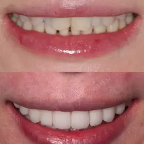 Dentist in Los Altos
PENINSULA CENTER FOR COSMETIC DENTISTRY - LOS ALTOS
99 3RD ST
LOS ALTOS CA 94022
http://www.pccdsmiles.com/