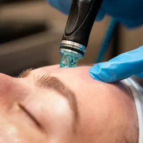 woman receiving hydrafacial