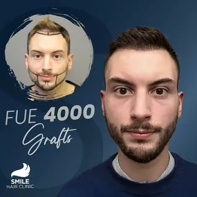 Bild von Smile Hair Clinic – Ihr NRW-Ansprechpartner für Haartransplantationen in der Türkei