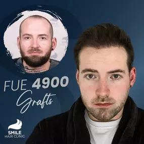 Bild von Smile Hair Clinic – Ihr NRW-Ansprechpartner für Haartransplantationen in der Türkei