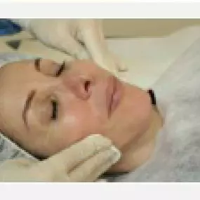 microneedling-2 | Praxis für med. Kosmetik | Diana Larisch |München