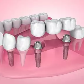 Bild von California Dental Care and Orthodontics