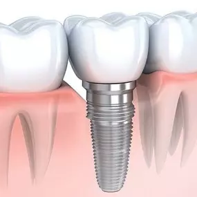 Bild von California Dental Care and Orthodontics