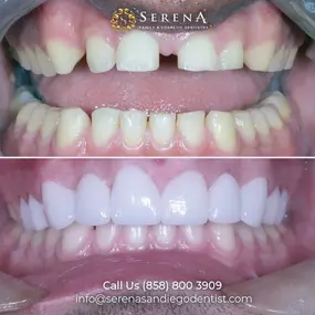 Bild von Serena San Diego Dentist