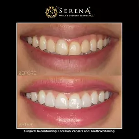 Bild von Serena San Diego Dentist