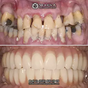 Bild von Serena San Diego Dentist