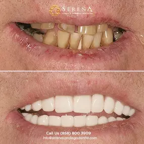 Bild von Serena San Diego Dentist