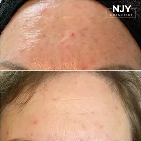 Bild von Enjoy Cosmetics | Kosmetikstudio Heilbronn | Hautpflege und Gesichtsbehandlungen in Leingarten
