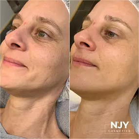 Bild von Enjoy Cosmetics | Kosmetikstudio Heilbronn | Hautpflege und Gesichtsbehandlungen in Leingarten