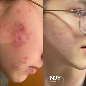 Bild von Enjoy Cosmetics | Kosmetikstudio Heilbronn | Hautpflege und Gesichtsbehandlungen in Leingarten