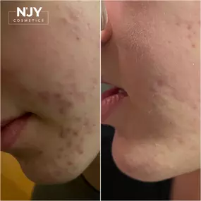 Bild von Enjoy Cosmetics | Kosmetikstudio Heilbronn | Hautpflege und Gesichtsbehandlungen in Leingarten