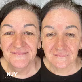 Bild von Enjoy Cosmetics | Kosmetikstudio Heilbronn | Hautpflege und Gesichtsbehandlungen in Leingarten