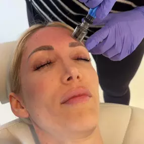 Sea Glass Med Spa provides microneedling services to support skin health and rejuvenation. Our treatments are designed to enhance skin texture and appearance, promoting a smoother and more refreshed look. With a commitment to quality care, we help clients achieve a radiant and revitalized complexion.