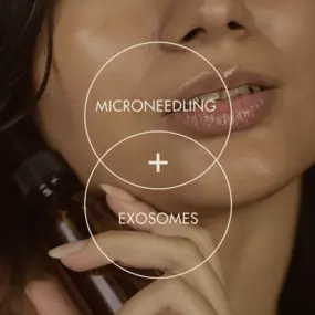 microneedling + exosomes