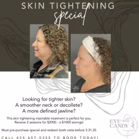 skin tightening