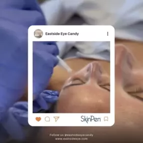 skinpen