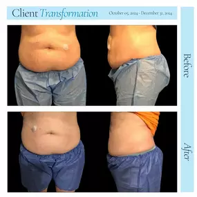 Bild von Hollywood Body and Face Wheat Ridge
