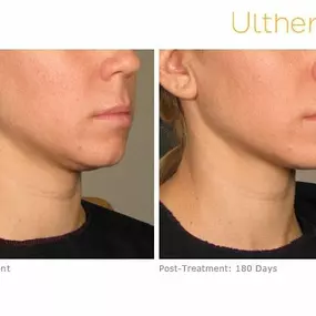 Bild von Hollywood Body and Face Wheat Ridge