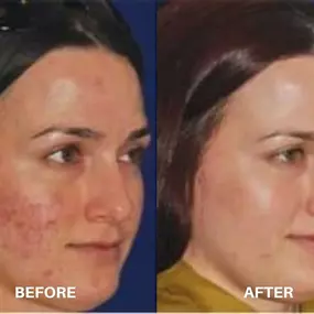 Bild von Hollywood Body and Face Wheat Ridge