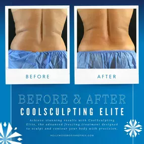 Bild von Hollywood Body and Face Wheat Ridge