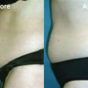 Bild von Hollywood Body and Face Wheat Ridge