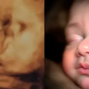 Bild von Chubby Cheeks 3D/4D Ultrasound Studio of Burlington